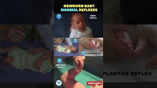 Newborn baby normal reflexes explained ✅ Moro reflex  Plantar reflex  Grasping reflex reflexes [upl. by Colwen]