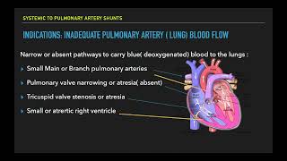 BlalockTaussig Shunt Introduction [upl. by Ynnus]