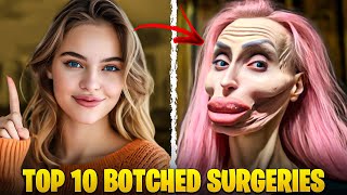 Botched Surgeries TOP 10 Countdown  Worst Medical Operations [upl. by Yerggoeg423]