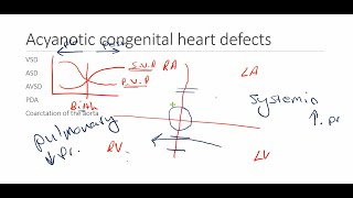 Acyanotic heart diseases [upl. by Felise]