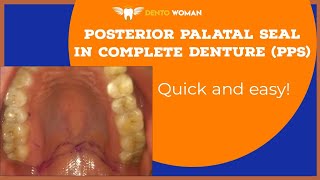 Posterior palatal seal  PPS  in complete denture amp How to record it  pps completedenture [upl. by Neetsirhc102]