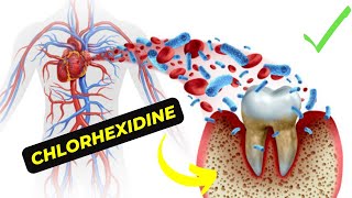 Guide to Chlorhexidine Benefits Uses and Side Effects [upl. by Mandelbaum409]