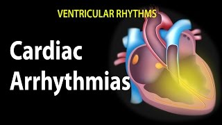 Cardiac Arrhythmias Animation [upl. by Caine]