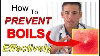 How to PREVENT Boils Effectively 4 STEPS  The Best Way to PREVENT Boils From Coming Back [upl. by Crin]