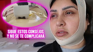 CÓMO SON LOS PRIMEROS 15 DIAS DESPUÉS DE UNA ABDOMINOPLASTIA Y LIPOESCULTURA TODOS LOS TIPS AQUÍ [upl. by Ives767]