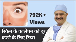 Skin Tanning amp Tips for Tan Removal स्किन के कालेपन को दूर करने के लिए टिप्स  In HINDI [upl. by Johm939]