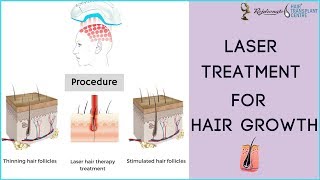 Dr Sam Lam Talks About the Capillus Low Level Laser Therapy LLLT for Hair Loss [upl. by Aicilak]