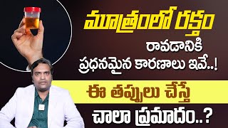 మూత్రంలో రక్తం  Symptoms and Causes of Blood in Urine Telugu  dr Ravi Teja  MhathiHealth [upl. by Berga]