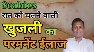 Scabies  Khujli  Itching खुजली का ईलाज [upl. by Ajdan85]