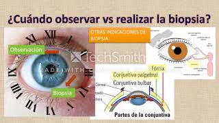 Melanosis Adquirida Primaria por Angie Gamboa [upl. by Icnarf]