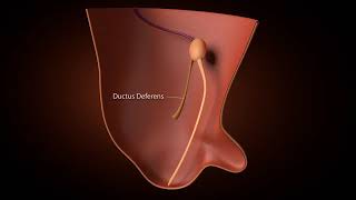 Development of inguinal Canal [upl. by Tiana]