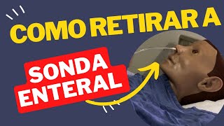 Técnica de Retirada de Sonda Nasoenteral simples e rápido nasctreinamentosenfermagem enfermagem [upl. by Marin]