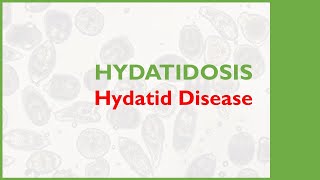 Hydatidosis Hydatid Diseases Lecture [upl. by Aicenav718]