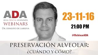 WebinarADA Preservación Alveolar [upl. by Nelyag]