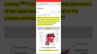 Stertor Noisy breathing sound like snoring [upl. by Morganne]