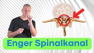 Spinalkanalstenose  Ursachen Symptome und Therapie [upl. by Thin]