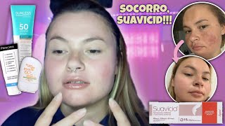 VOLTEI A USAR A POMADA SUAVICID  MELASMA  HIDROQUINONA  Ket Brinhol ✨ [upl. by Terrell288]