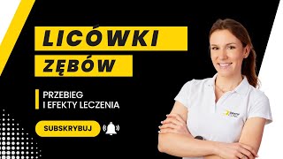 Licówki zębów Przebieg i efekty leczenia [upl. by Stedman720]