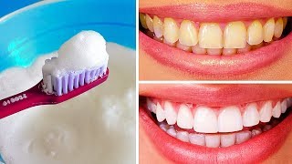 10 Natural Ways to Whiten Teeth at Home [upl. by Eade420]