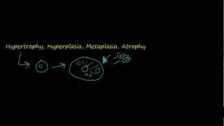 2  Introduction to pathology  hypertrophy hyperplasia [upl. by Waters]