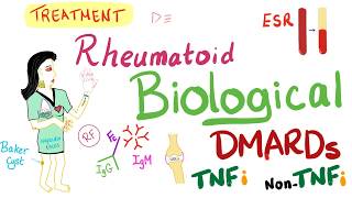 Rheumatoid Arthritis RA  Management  DMARDs  TNF  Rheumatology Series [upl. by Rephotsirhc598]