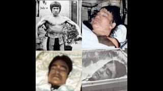 How did Bruce Lee die His doctors speak [upl. by Enairda]