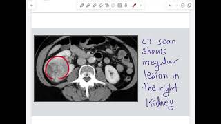 Urological Investigations  P2  urology [upl. by Nicholson574]