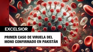 Primer caso de viruela del mono confirmado en Pakistán [upl. by Blunt]