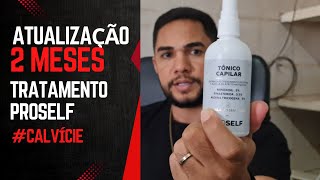 RESULTADO 2 MESES MINOXIDIL E DUTASTERIDA PROSELF [upl. by Sigvard]