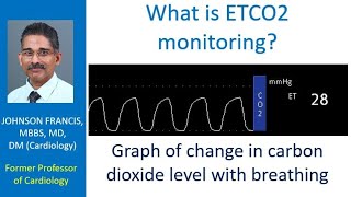 What is ETCO2 monitoring [upl. by Alor]