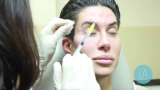 Justin Jedlica gets Botox [upl. by Tiphane573]