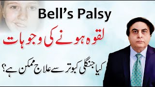 Bells Palsy  Laqwa ka Ilaj  Facial Paralysis Causes amp Treatment By Dr Khalid Jamil [upl. by Attolrahc112]