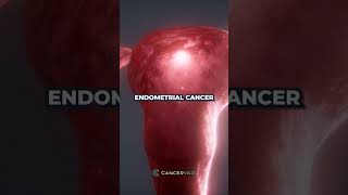 FDA Approves New Immunotherapy Treatment for Endometrial Cancer [upl. by Anal]