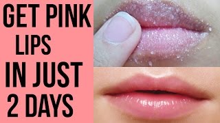 How to get pink lips Lighten dark lips naturally at home Get Rid Of Chapped Lips [upl. by Keely386]