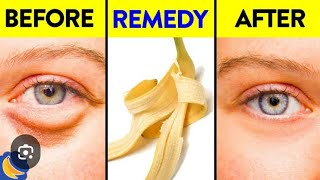 banana peel facial  results in 5 minutes  for dark circles 👆 [upl. by Etheline]