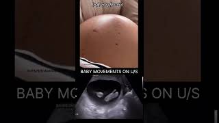 9 Months Pregnancy Baby Movement [upl. by Ahsratal882]