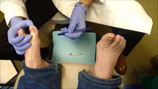 East Texas Foot and Ankle Centers Ingrown Toenail Intro 1 [upl. by Kalam]