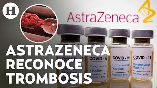 ¿Qué es y cuáles son los síntomas de la trombosis enfermedad ligada a la vacuna de AstraZeneca [upl. by Dauf909]