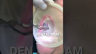 Filling Cavity Dental Dam Isolation  In Office to Hands On Dental Training [upl. by Fortunna442]