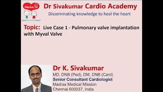 910 Live Case 1  Pulmonary valve implantation with Myval Valve [upl. by Llenrad718]