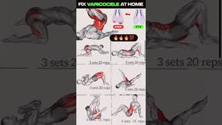 Fix varicocel exercise at home 🏡 MrBeast varicoceletreatment motivation sports trending 💔💯🎧 [upl. by Hillyer]