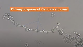 Chlamydospores of Candida albicans observation [upl. by Oirretna]