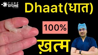 Dhaatधात 100 ख़तम  Dhaat Syndrome Hindi  धात रोग क्या और कैसे होता है  धात रोग का इलाज [upl. by Pellet305]