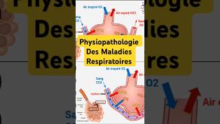 Physiopathologie Maladies Respiratoires pneumologie bronchite asthme fibrosepulmonaire poumon [upl. by Aihsad714]