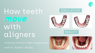 How teeth move with aligners  now explained [upl. by Egief202]