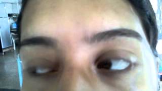 Abnormal eye movements [upl. by Auos]