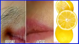 Unwanted hair removal for women naturally with lemon remedy  face hair removal for women at home [upl. by Cordula]