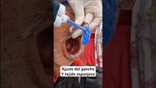 prostodoncia protesisdental dentista protesisdentales protesista doctor [upl. by Haral]