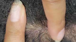 Finger Dandruff Scratching Nails ASMR 48MINS  FORTY EIGHT MINS SLEEP RELAX STUDY Relaxation Peace [upl. by Atir]