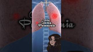 CavityCausing Pneumonia causativeorganisms shorts medicalshorts [upl. by Alrrats853]